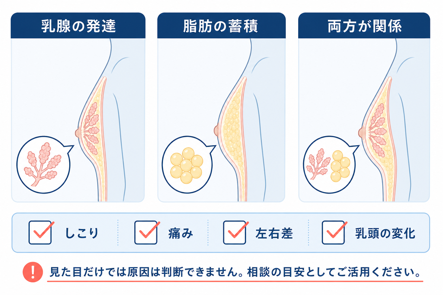 男性の胸のふくらみについて、乳腺の発達・脂肪の蓄積・両方が関係する場合と相談時の確認項目を示す図